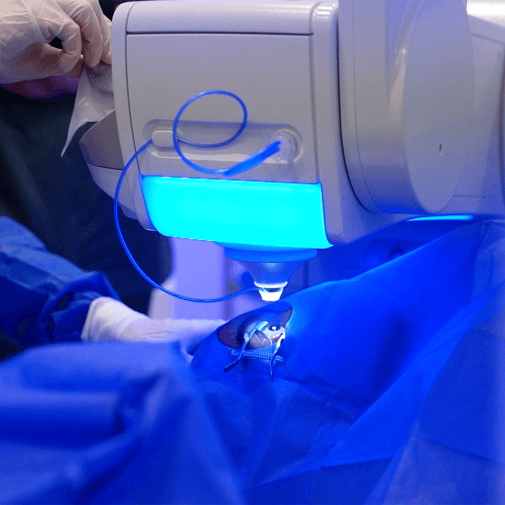 Zeiss VisuMax 800 Laser Operation